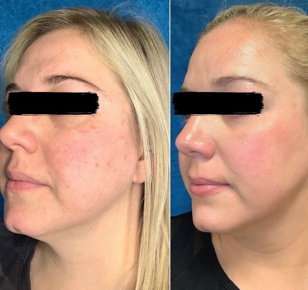 xr:d:DAFGPWEPm7I:2,j:30634985310,t:22071221