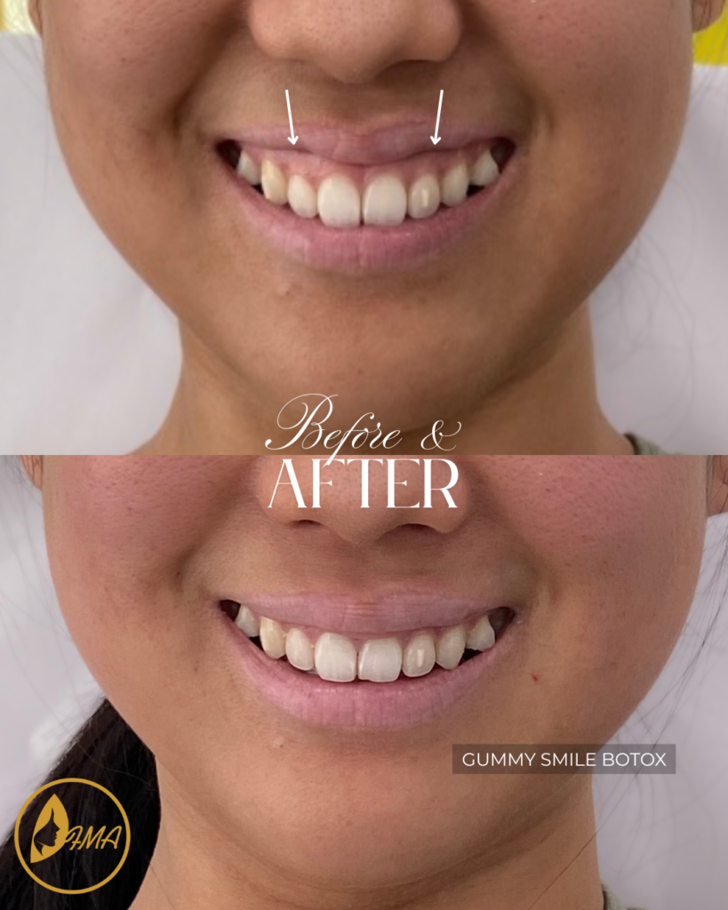 Untitled design-15 copy