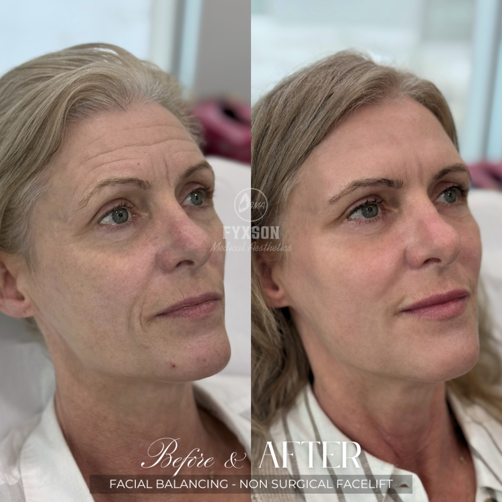 facial balancing ad png